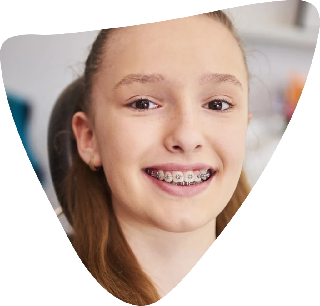 orthodontics hervey bay