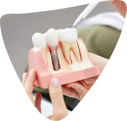 dental implant treatment