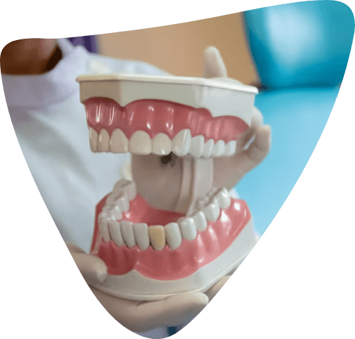 Hervey bay dentures dentist QLD